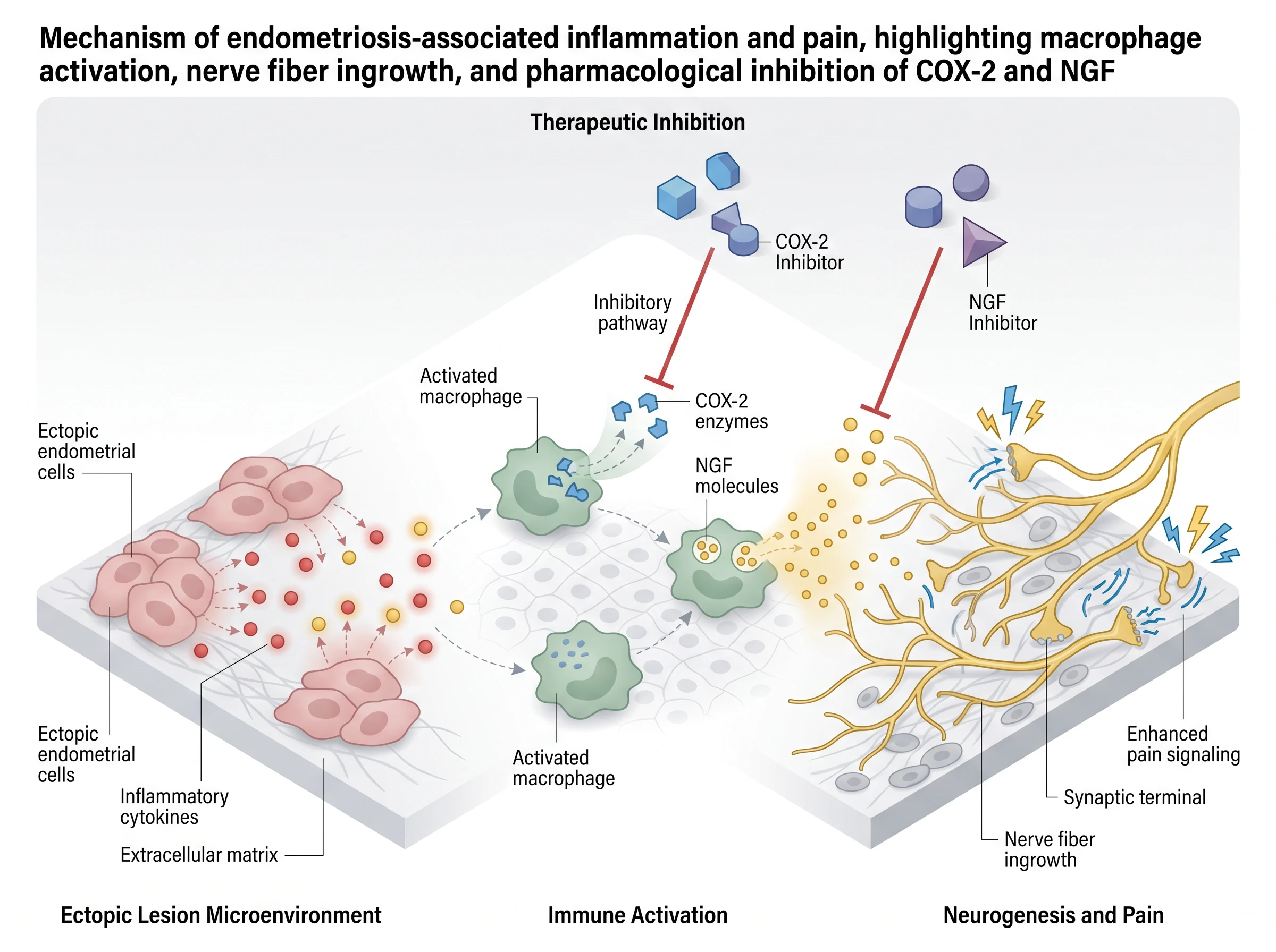 Endometriosis Inflammatory Pain Axis