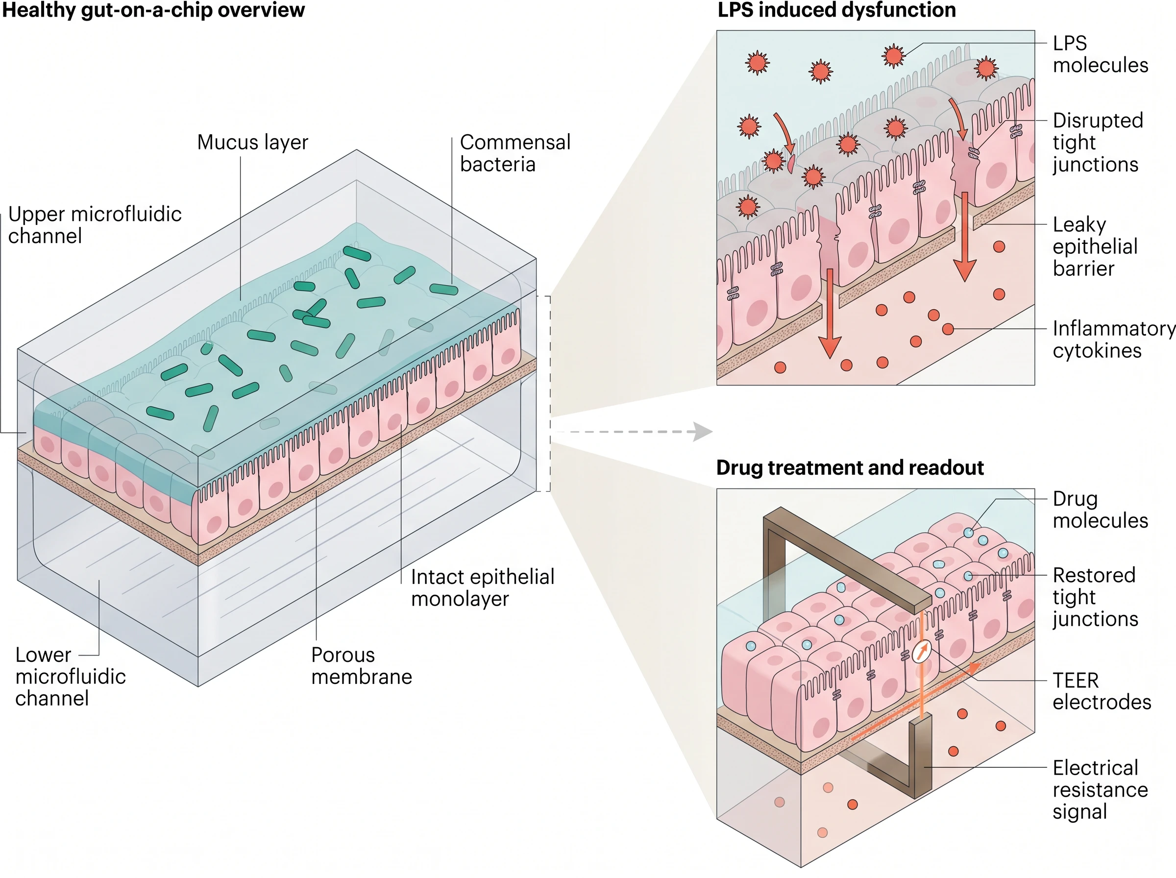 Gut Barrier Inflammation Chip