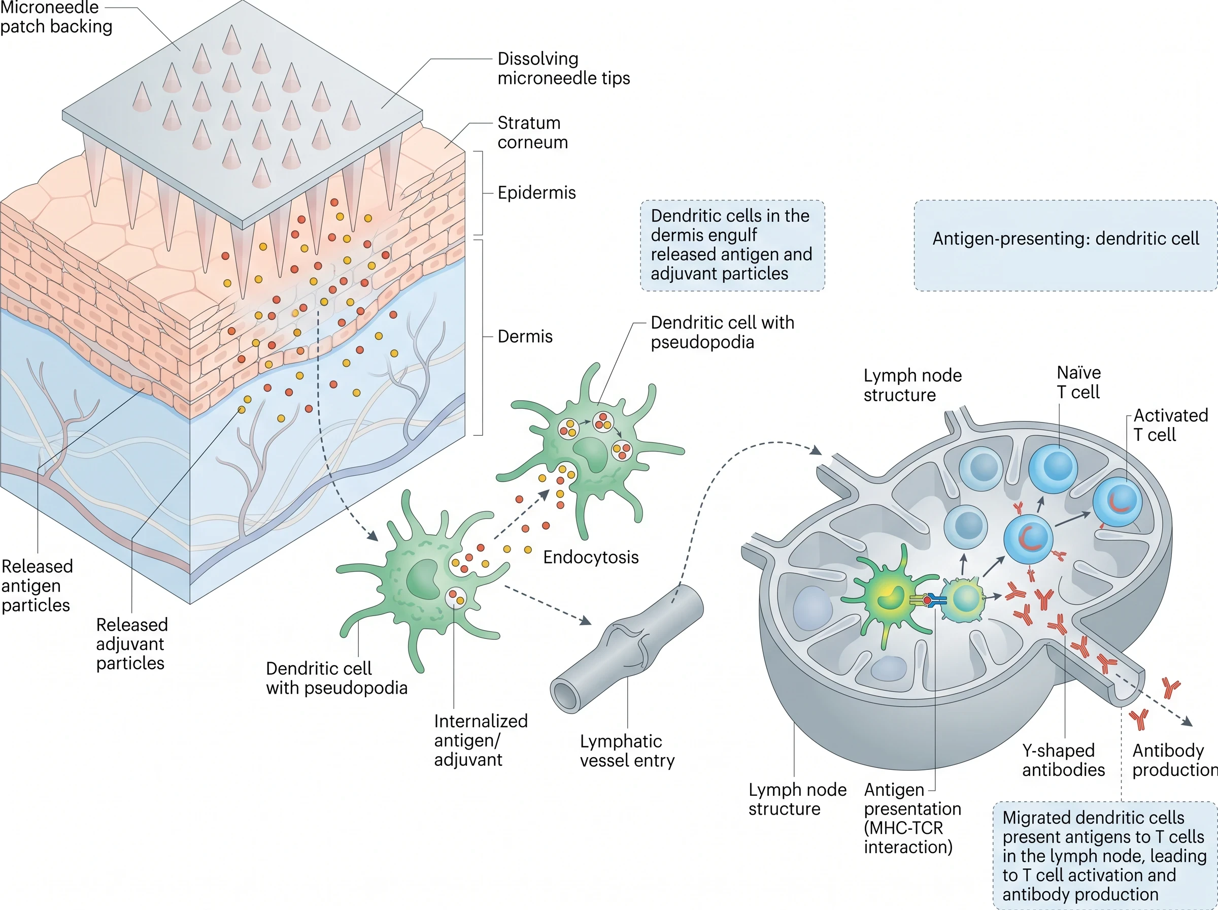 Microneedle Vaccine Delivery