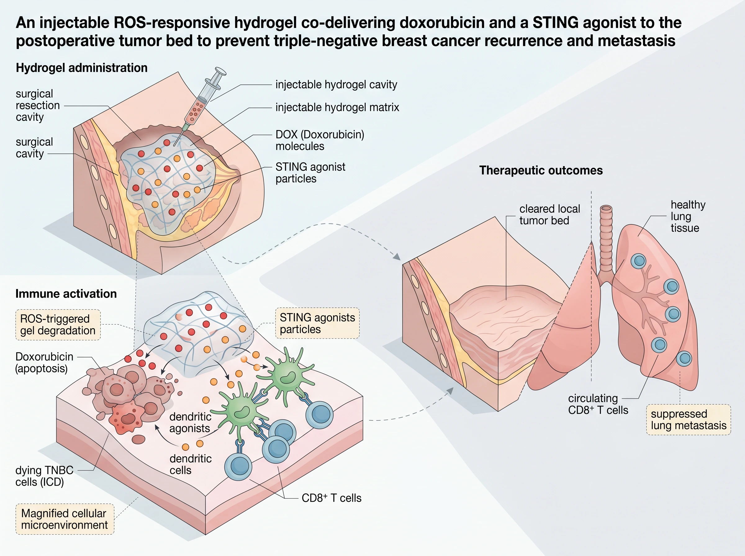 ROS-Responsive Hydrogel for TNBC Immunotherapy
